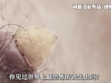 世界上超恐怖的寄生虫:把人类当作宿主榨干,再让宿主跳水自尽! #寄生虫 #铁线虫 #涨知识