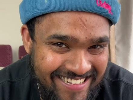 这样做鸡蛋,小孩和老头一起馋哭啦😍😍#印度美食 #美食趣胃计划 #抖音美食创作人