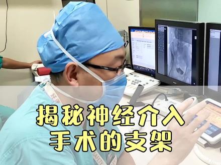 揭秘神经介入手术的支架#神经介入 #手术支架 #神经外科