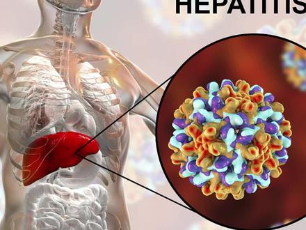 乙肝是怎么一天一天也变成演变成肝癌的?