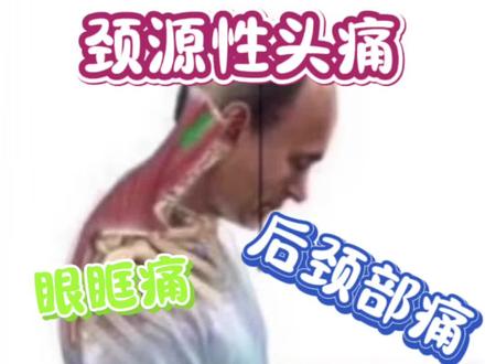 颈源性头痛的自我管理与治疗#颈椎病 #颈源性头痛 #后脑勺痛 #太阳穴痛 #拉伸