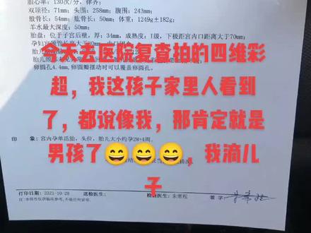 #铜陵 这小脸型一看就是个男孩😄😄