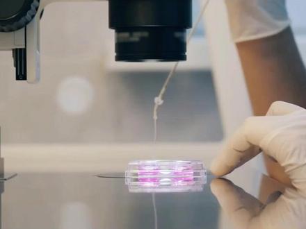 专家呼吁加强精子捐献监管:消除癌症基因跨国传播的风险 近期,一则关于精子捐献者携带致癌基因并将其传递给后代的案例引起了广泛关注。这一事件揭示了当前在欧洲以及国际范围内,精子捐献的监管存在严重漏洞。专家们认为,必须采取更严格的措施,避免类似问题的发生。
法国鲁昂大学医院的癌症遗传学专家卡斯珀博士(Dr. Edwige Kasper)在欧洲人类遗传学大会上表示,由于欧洲各国之间缺乏统一的监管标准,精子捐献者的精子可能在不同家庭中被多次使用,这不仅增加了近亲繁殖的风险,还可能导致遗传性疾病的异常传播。
2023年底,卡斯珀博士的实验室接到了一名法国临床医生的报告,称他的患者收到了来自某欧洲私人精子库的通知,告知该精子捐献者的TP53基因出现了“未知意义的突变”,这种突变出现在该捐献者的精子中不到50%。TP53基因负责制造肿瘤抑制蛋白,起着抑制肿瘤发生的作用。尽管捐献者本人身体健康,但他的子女可能面临李-弗劳梅尼综合征(Li-Fraumeni Syndrome)的风险,这是一种遗传性疾病,易导致各种癌症的发生。
通过进一步的研究,卡斯珀博士发现,来自这个捐献者的精子可能已经导致了23个孩子携带该基因突变,且其中10名孩子已被确诊为癌症。针对这些孩子,医学界已经展开了密切的监控和早期筛查,包括全身MRI扫描、大脑MRI和腹部超声等检查,力图早期发现肿瘤并提高治愈率。
卡斯珀博士指出,由于李-弗劳梅尼综合征的动物实验表明,暴露于化学药物或X射线会加速肿瘤的发展,因此这些孩子应该避免使用放射线检查,如乳腺X光和PET扫描等。