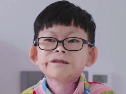 13岁男孩:我希望大家现实中遇到我们,把我们像正常人一样对待 @Summer 陈奕瑜妈妈 #蝴蝶宝贝 #罕见病 #纪录片 #坚强的孩子 #妈妈