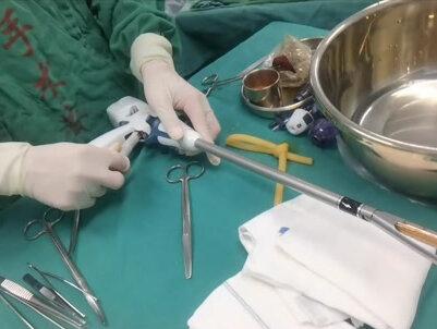 今天跟大家#揭秘一下我们做腹腔镜手术很常用的一款器械,快来看看吧!#医学科普