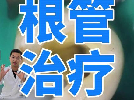 你的牙齿要做根管吗 #健康科普有真知 #根管治疗
