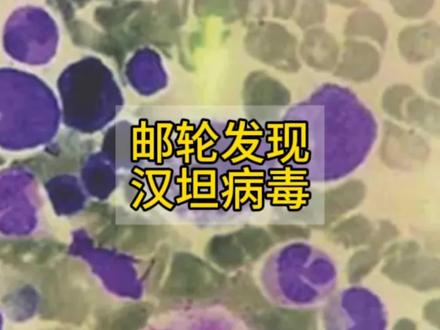 荷兰邮轮发现汉坦病毒#汉坦病毒 #邮轮#阿根廷 #南非 #西班牙