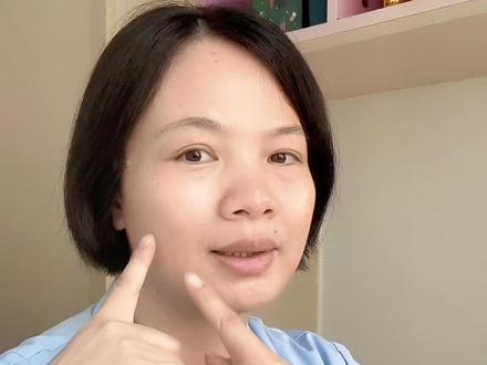 挤黑头留下的坑自己会好吗#好皮肤养出来