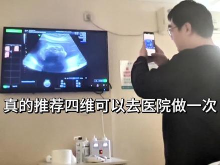 他的模样在我这儿具像化了,不得不说,私立的四维彩超体验感拉满#一个身体两个心跳 #孕期记录 #大排畸 #四维彩超 #孕检