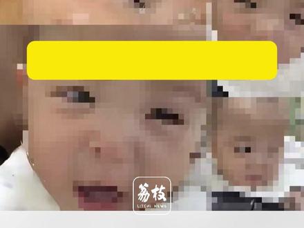 【宁波卫健委回应手术离世女婴最新进展:
尸检报告由三方共同委托
医疗事故鉴定程序仍在进行中
后续将依据鉴定意见处理】
12月20日 浙江宁波,荔枝新闻记者从“手术后离世女婴”小洛熙爸爸处获悉,家属已于昨日(19日) 通过宁波市卫健委获取了完整的尸检报告。据家属公布的部分报告显示 ,“未检见冠状窦型房间隔缺损”,“符合因继发孔型房间隔缺损行修补术并发心力衰竭、呼吸功能衰竭而死。”
12月20日下午17时许,宁波市卫健委工作人员回应荔枝新闻记者称,该尸检报告由医院、患儿家属、卫健委三方共同委托相关机构出具,目前尸检工作已结束,正在进行医疗事故鉴定后续程序,尸检报告将予以考量,后续将依据医疗事故鉴定结果对涉事责任医师作出处理。
另据12月14日宁波市卫健委通报,12月12日,当地法院已受理患儿家属提出的诉讼。该委调查组已对发现的病历违规问题立案调查。涉事主刀医师陈某贤、麻醉科主任等相关责任人员被免职,院方多人被处分。