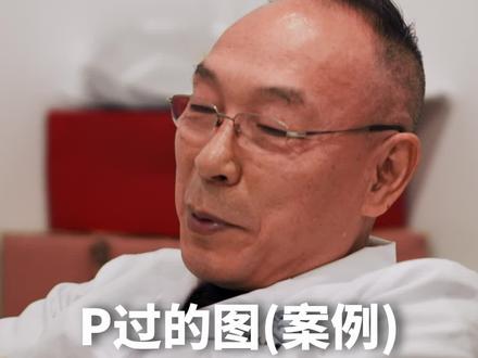 原生态的对比#内容过于真实 #下颌角 #磨骨