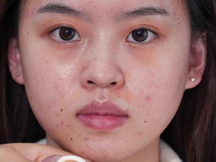 痘痘肌瑕疵皮化个甜妹约会妆 #化妆教程#妆前妆后#约会妆