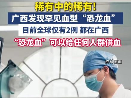 广西发现罕见血型“恐龙血”目前全球仅有2例,都在广西。“恐龙血”可以给任何人群供血,比“熊猫血”更罕见#广西 #血型 #恐龙血 #熊猫血 #稀有血型