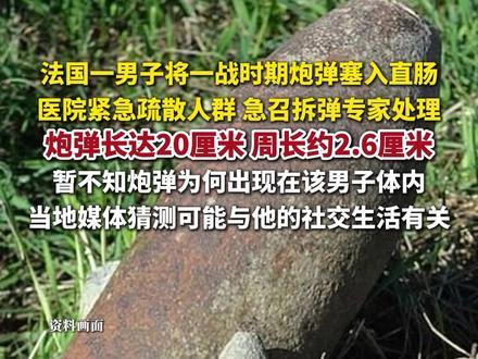 法国一男子将炮弹塞入直肠,医院急召拆弹专家处理。