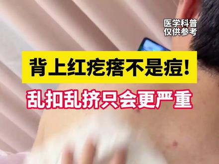 前胸后背长红疙瘩,千万别当普通痘痘! 医生教你一招,科学处理!#痘痘 #细菌性毛囊炎 #后背长痘痘的原因和解决方法 #抖出健康知识宝藏