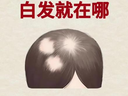 纳闷了,真的没人发现嘛?#结束了#白发#养黑#藻油#分享