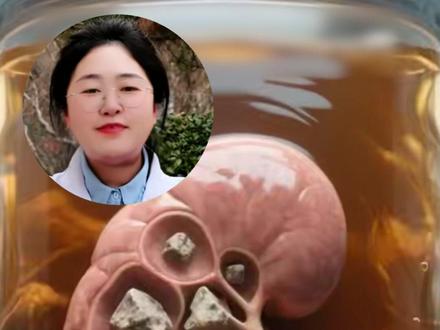 85%的结石都不用手术,我教你一碗“排石汤”,回家煮水喝就行了,3块钱都花不到!#结石 #中医 #中医养生 #医学科普 #健康科普