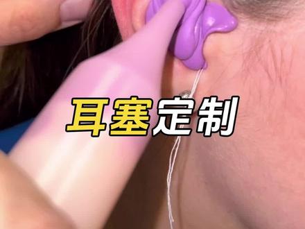 专属耳塞定制过程#耳塞定制 #耳朵 #耳机