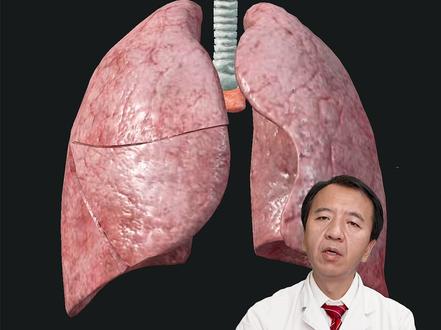 同样是肺癌,为何有的长期生存,有的5年过世? 肺癌是我国第一大癌,有的人经过积极治疗,5年后复查一切正常,而有的人在5年内就出现了复发转移。为何会出现这些情况?决定肺癌预后的主要因素是啥?一个视频讲清楚。#肺癌 #肺腺癌 #肺癌晚期 #肺鳞癌 #抖出健康知识宝藏
