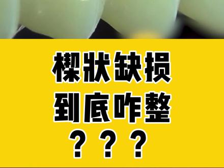 快来看,楔形缺损是这么补上的!#医学科普 #楔形缺损 #补牙