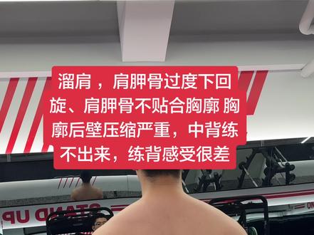 溜肩 ,肩胛骨过度下回旋、肩胛骨不贴合胸廓 胸廓后壁压缩严重,中背练不出来,练背感受很差。 这次分享的是呼吸以及前锯肌激活训练,(前锯肌是肩胛骨上回旋最有力量的肌肉)
下次分享溜肩,肩胛骨下回旋体态以及肩胛骨不贴合胸廓的 常规力量训练,还有教练怎么去辅助,超级干货。敬请期待吧!#杭州自由教练 #杭州体态调整 #杭州健身私教 #杭州健身教练 #体态纠正