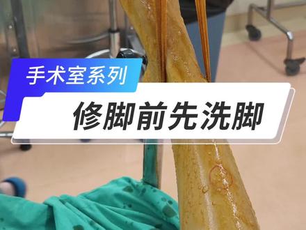 从来没洗过这么干净的脚🦶 修脚送洗脚#广东省中医院谢杰伟