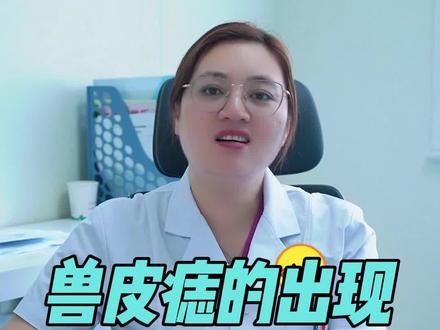 兽皮痣是怎么回事?可以在b超下发现吗?#怀孕 #医学科普 #妇科知识科普 #听英姐聊孕事 #兽皮痣