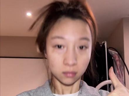 淡印子快准狠的科颜氏安白瓶,真的有用吗?#痘印#测评#精华#科颜氏淡斑精华