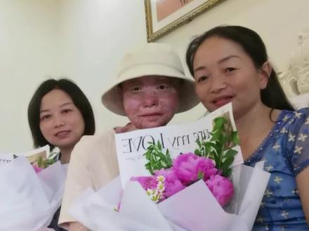 亲爱的妈妈 感谢您不是超人 却为我成为了万能#我的超人妈妈 #母亲节快乐 #四川乐山烧伤女孩乔燕 #抖音小助手