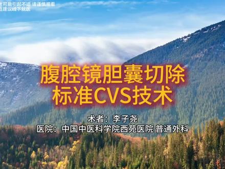腹腔镜下胆囊切除CVS技术#胆囊切除 #胆囊结石 #胆囊息肉 #西苑医院 #普通外科