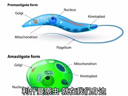 又见“黑热病”——利什曼原虫病