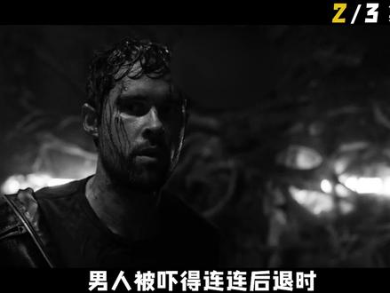 女人嘴里长出狗牙#悬疑 #猎奇 #狗牙 #狂犬病