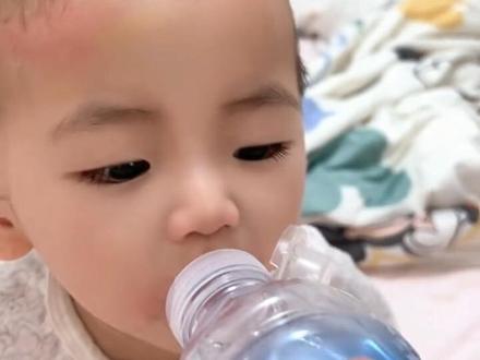 接上个视频|手足恢复过程
真的感谢很多热心网友的建议
第一天小宝有些发烧,当时腿上就几个痘痘,立马看了医生说是手足口,嘴巴很多泡,医生是说没有特效药,开了阿昔洛韦和利巴伟林,还有一个头孢消炎,到了下午突然就长满了全身发展很快,坚持涂了一天药膏,感觉很严重,疹子变成水泡特别是膝盖很多,才有了上一条视频,查了很多资料说是要有一个自愈过程,经历过这过程真的很煎熬,两天不喝奶不喝水,嘴巴的泡加上全身上下折磨的一直哭闹,第三天决定带他去吊点水,挂了主任办了住院,其实也就是补了营养液,打了钾和葡萄糖,身上一天三次炉甘石和阿昔洛韦交替涂,嘴巴喷开喉剑和利巴伟林抗病毒交替使用,还涂了康复新液脸上和嘴巴愈合快,到第四天稍微能喝点粥和奶,身上还有水泡,给他买了尖叫很爱喝起码能补充点水分,第五天喝了不少粥,奶也基本恢复了,身上没什么疹子,膝盖和手臂的泡也消了有些结痂,本来准备再吊一天水出院,一看留置针掉出来了,能吃能喝本来也就补营养液葡萄糖,决定直接不打出院,其实只要能吃能喝的情况手足口都是能治愈只是要一个过程,都要经历起疹 . 出泡 . 结痂 .脱皮 .有些会脱甲的过程,没想过手足口会这么严重,现在高发期真的要少和小朋友接触,传染性极强居家隔离,过程太煎熬越来愈好吧,希望经验能帮助到自愈中的小朋友得到缓解。#手足口#手足口治疗过程