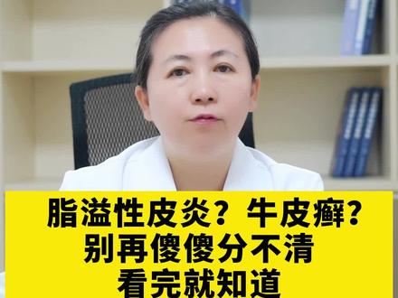头皮 #脂溢性皮炎 和头皮#牛皮癣 别再混淆了,看完视频就知道了 #银屑病 #头皮脂溢性皮炎#医学科普#健康科普 #皮肤科医生徐国梅