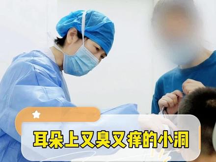 #耳朵 上臭臭的会流脓的小洞到底是什么,需要治疗吗?#耳前瘘管 #医学科普 @抖音小助手