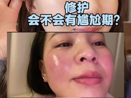 屏障受损,修护会不会有尴尬期!#大红脸 #屏障修护 #玫瑰皮