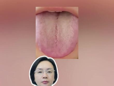 脾虚+肾虚+肝郁+湿热一起出现,千万别上来就清湿热,或者补肾#舌象 #医学科普 #抖出健康知识宝藏 #科普健康知识
