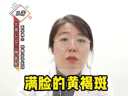 满脸的黄褐斑,中医内调淡化