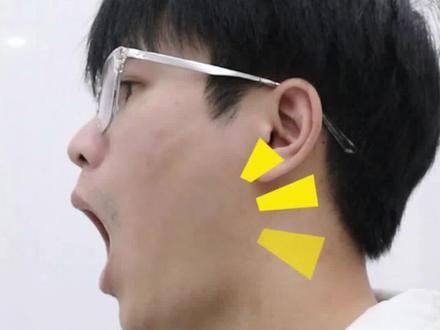 张嘴#下巴弹响 往往伴随着#下巴歪斜 跟着我做这两个动作改善 #运动康复