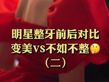 明星牙齿矫正系列二来啦,来看看他们的效果怎么样。
#牙齿矫正 #迪丽热巴 #蔡徐坤 #白鹿