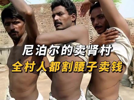 尼泊尔的卖肾村,卖肾只为娶媳妇养家糊口,价格却低到离谱#风土人情 #黑人小哥 #奇闻异事
