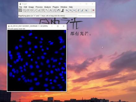 用imagej对细胞核自动计数(相似结构也行) 显微镜数据我们经常要进行统计分析,那我们的荧光数据里面有大量的数据需要统计的话,我们手动计数效率明显就会特别低。这个时候就可以用我们imagej进行自动统计,省时省力,结果还出的快,具体操作如下:
细胞核选取:Image——Adjust——Threshold
不完整细胞核填充:Process——Binary——Fill Holes
相邻细胞核分割:Process——Binary——Watershed
细胞核计数:Analyze——Analyze Particles
统计数据展示
以上操作很快就能统计出细胞核(或者结构类似)的数量啦,同时如果有荧光亮度或者面积都是可以一块儿在数据中展示出来的,大家快来试试吧。
#imagej #数据分析 #图像处理 #科研 #学习