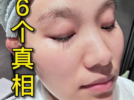 养好皮肤了,说一些关于修护屏障的大实话 #好皮肤养出来