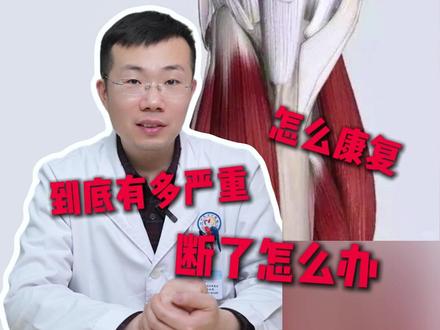 最怕的伤病:肌腱断裂 肌腱断裂后果有多严重?断了该怎么办?#肌腱断裂 #股四头肌肌腱断裂 #倒蹬机训练 #膝关节疼 #练腿