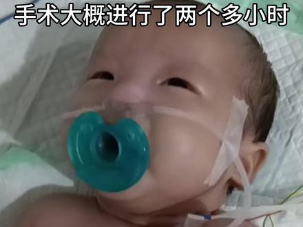 我家二宝刚满月确诊脊髓栓系 ,回忆那段经历充满心酸 ,手术很成功 没有大家想象的那么可怕 #脊髓栓系 #新生儿