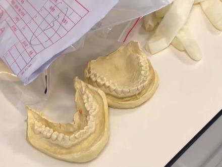 50岁微整龅牙啦~再给自己一次变美的机会 #马晴#猛晴 #日落时分说爱你 #日落时分说爱你马晴#整牙