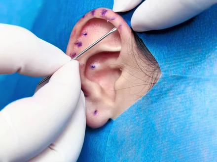 一次性穿30个耳洞?左耳来了#昆明#五华区#穿孔师蛋挞