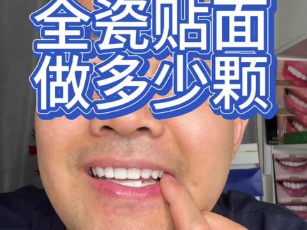 想做牙贴面的朋友可以看一下#牙贴面 #全瓷贴面 #变美