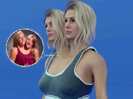 世界上最罕见的连体人 #内容启发搜索 #趣闻