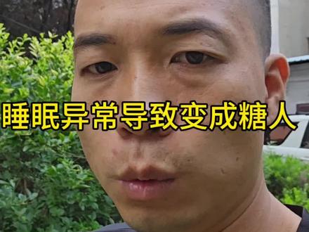 睡眠异常导致变成糖人。#糖尿病#控糖#血糖